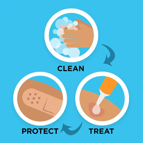 Waterdichte Pleisters met Ademend Kussen – Medische EHBO Wondpleisters & Hemostatische Stickers